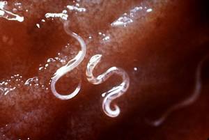 Hookworms attached to the intestines.